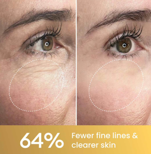 GloraMD Face Lift Serum worth