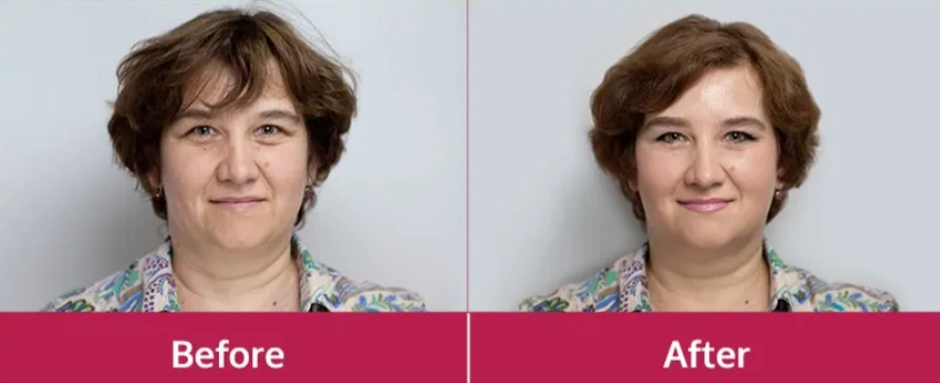 Glowic Serum Before & After