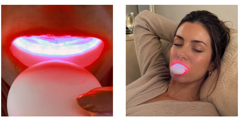 Toothcare Red Light Gum Device How To Use